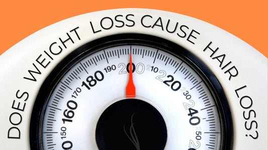 does weight loss cause hair loss