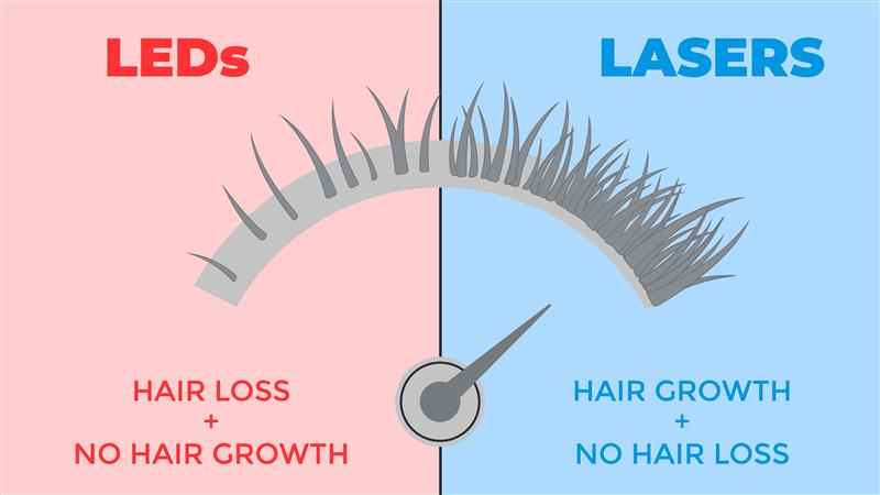 laser vs led for hair loss