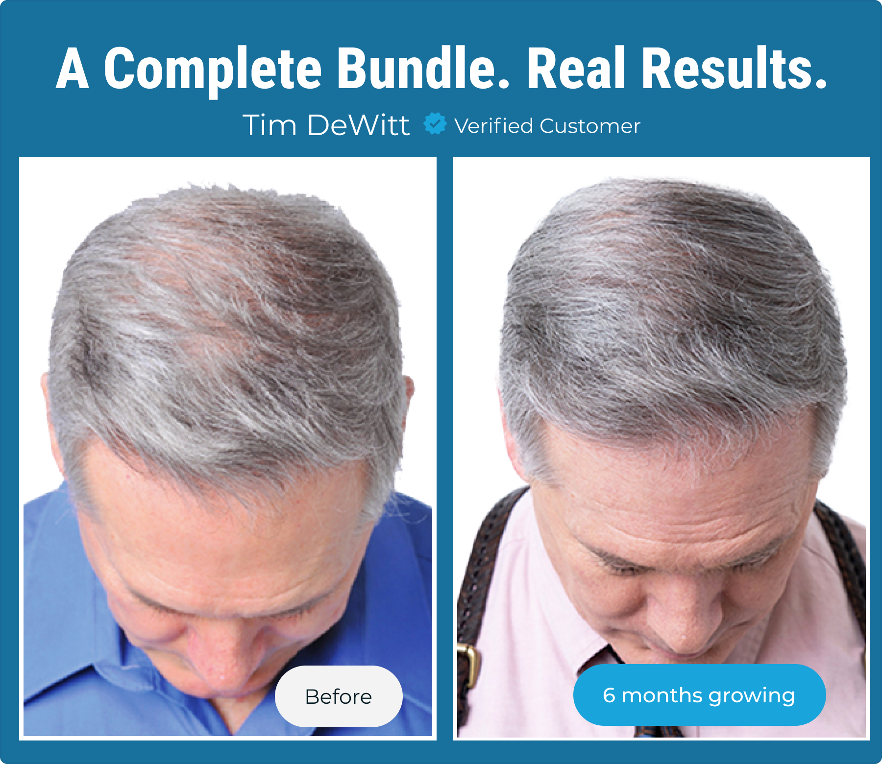 Complete Hair Growth Bundle