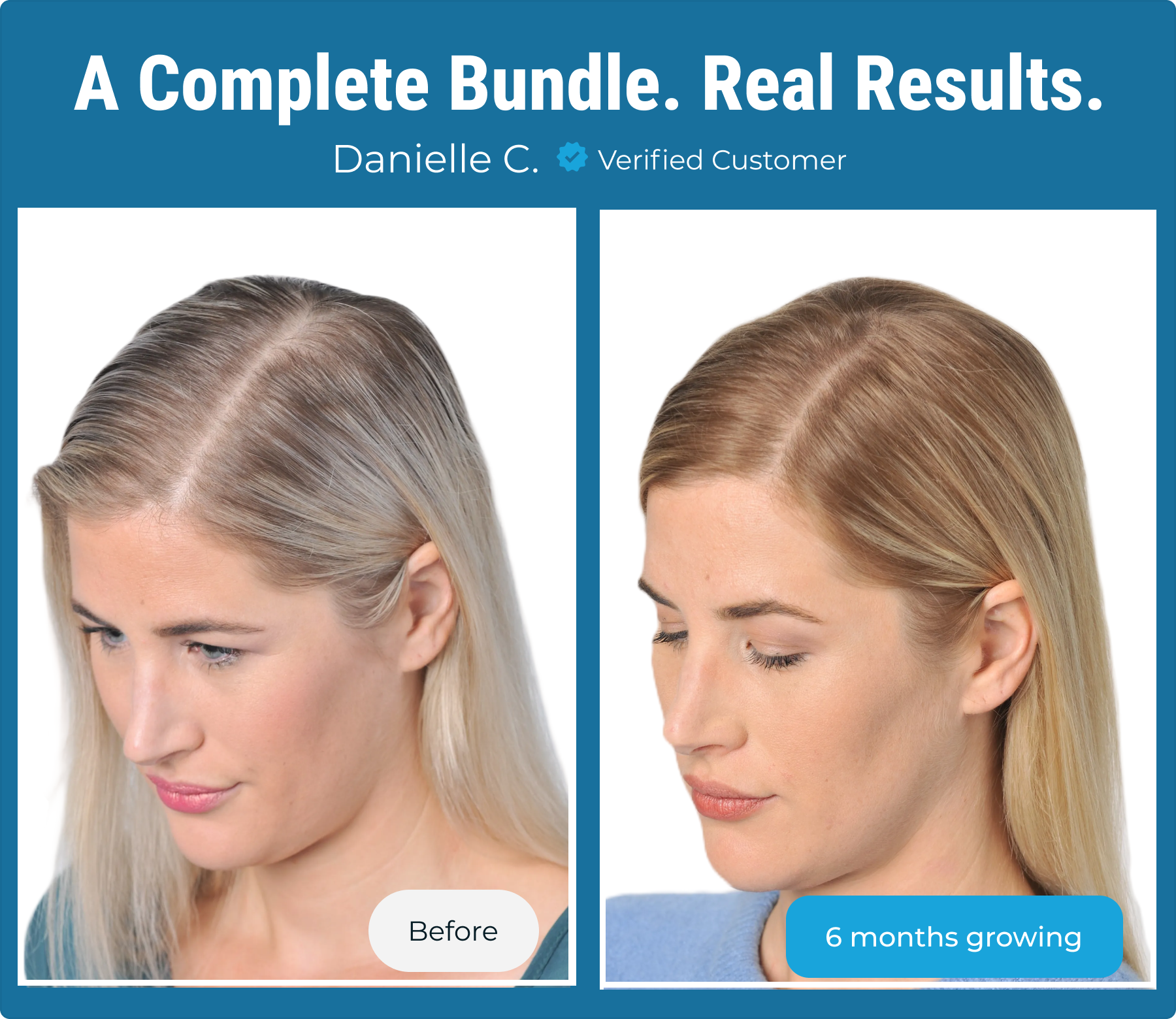 Complete Hair Growth Bundle