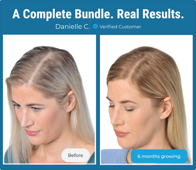 Complete Hair Growth Bundle