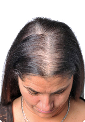 After Image 1