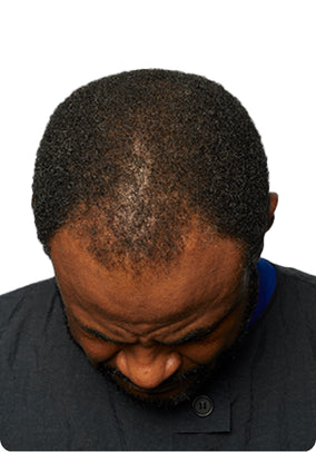 After Image 2