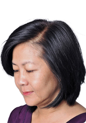 After Image 1