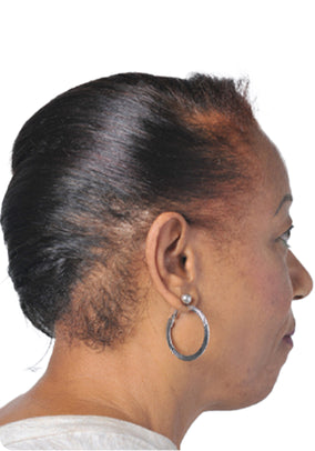 After Image 1