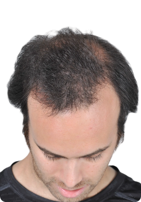 After Image 1