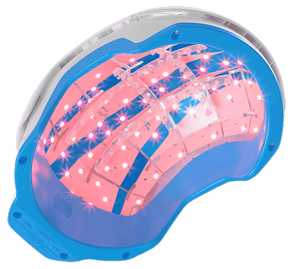 theradome helmet