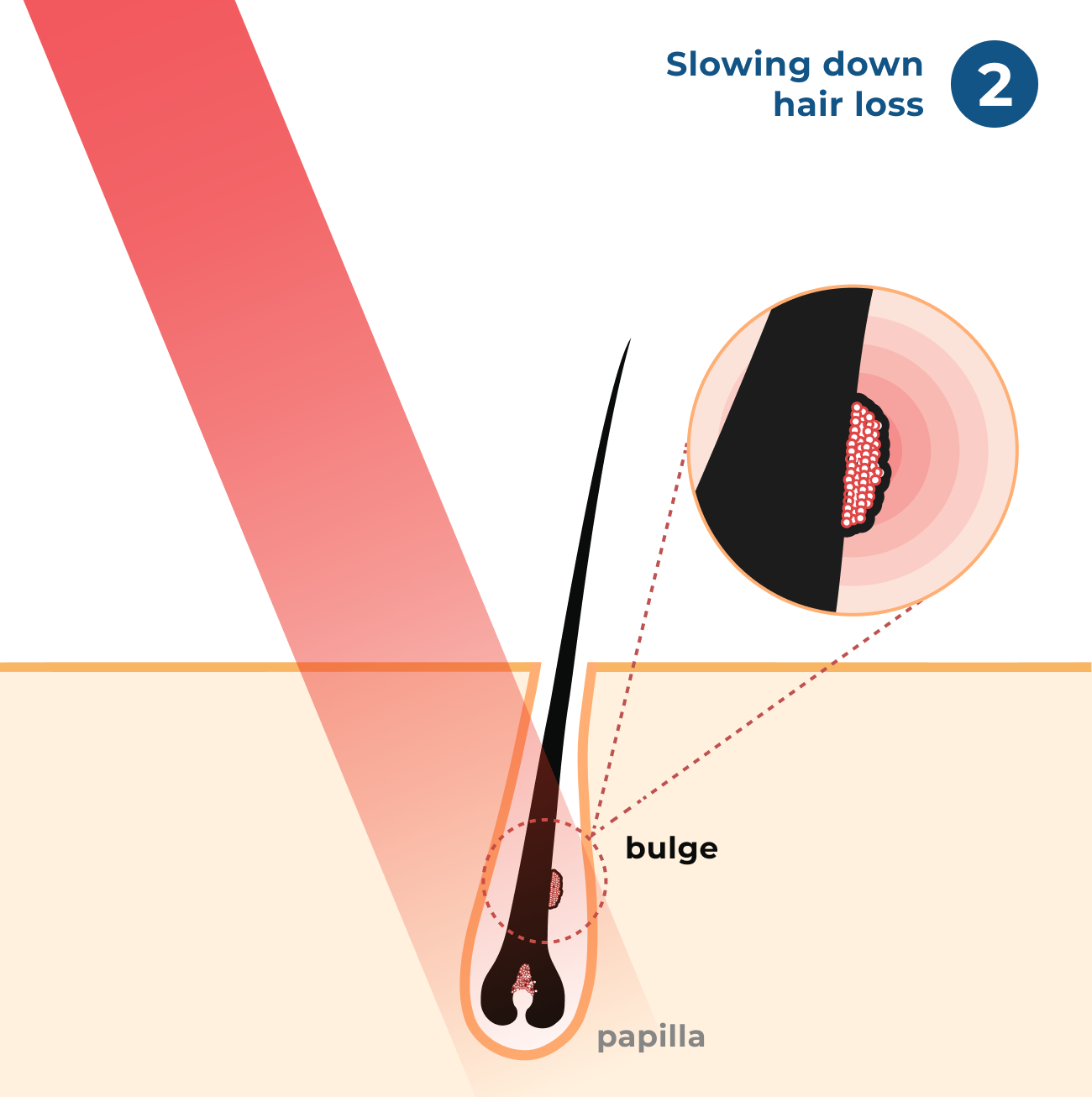 Step 2: Slowing down Hair Loss