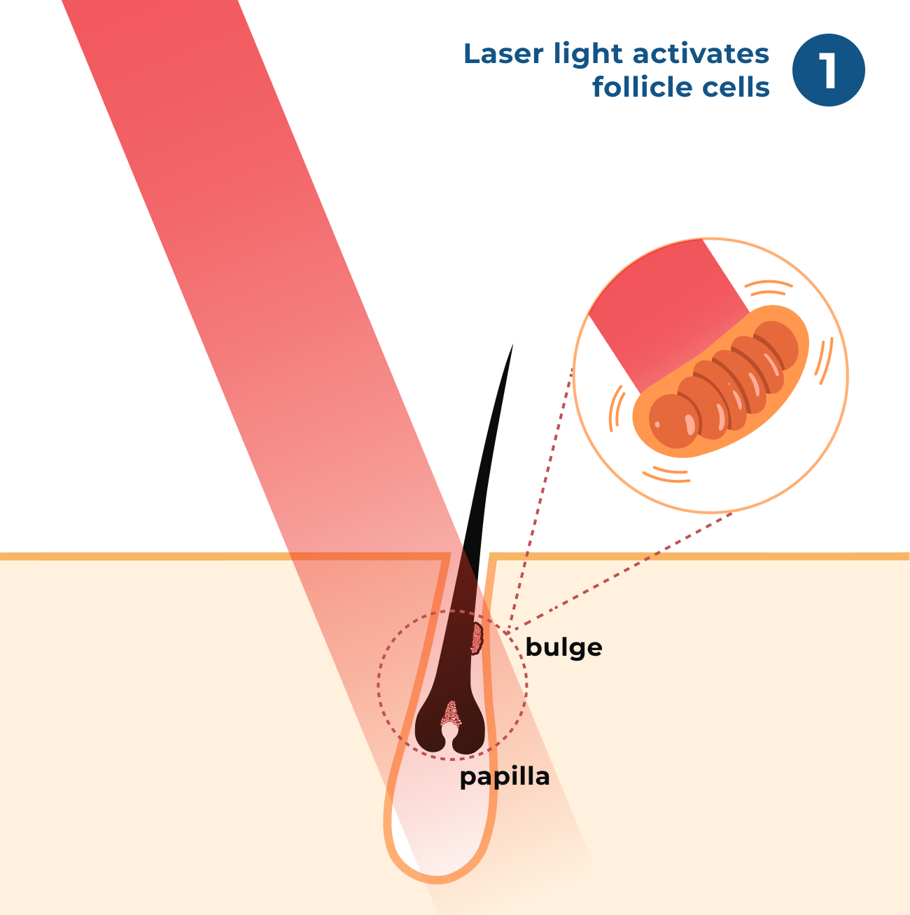 Step 1: Laser Light Activates Follicle Cells