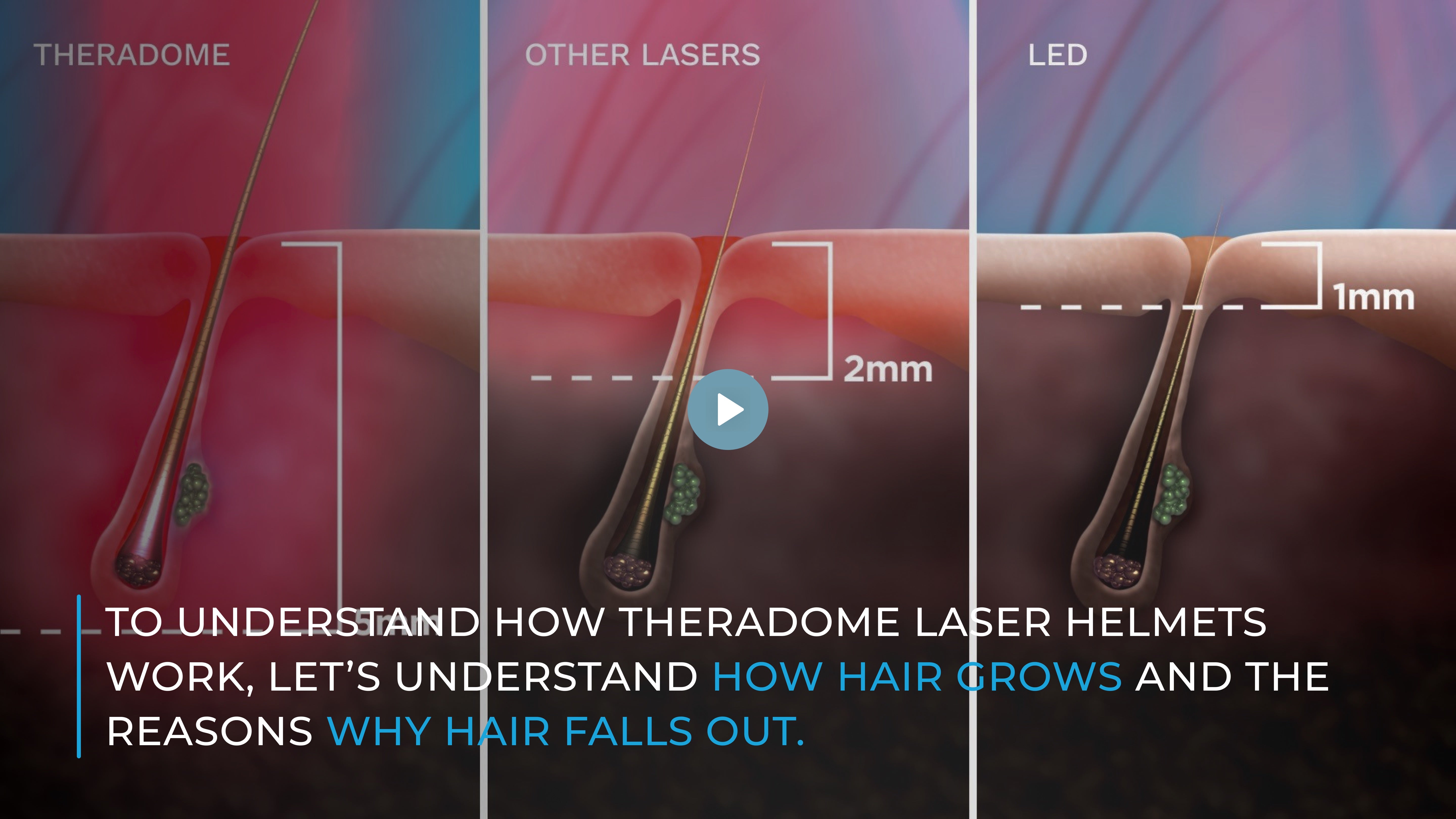 Theradome EVO - Laser Hair Growth - No Placebo LEDs